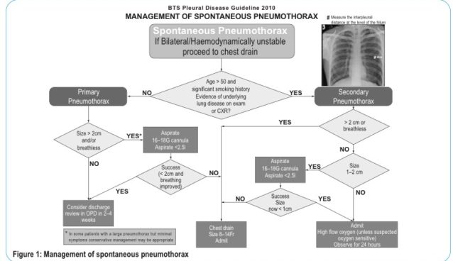 Pneumothorax-flowchart2.jpg