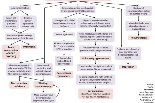 COPD-Complications-1024x768.jpg