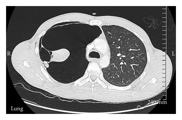 CRIM.PULMONOLOGY2011-957463.002.jpg