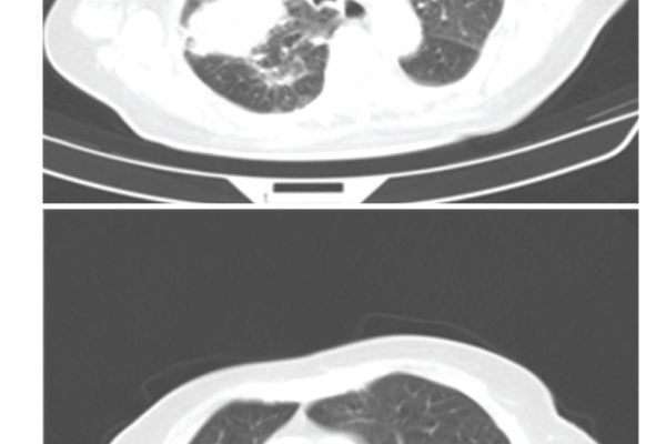 CRIM.PULMONOLOGY2012-610949.002.jpg