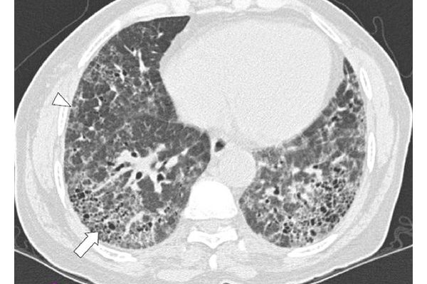 CRIM.PULMONOLOGY2012-684285.003.jpg