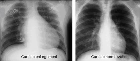 ej-vol7n16-fig2.jpg